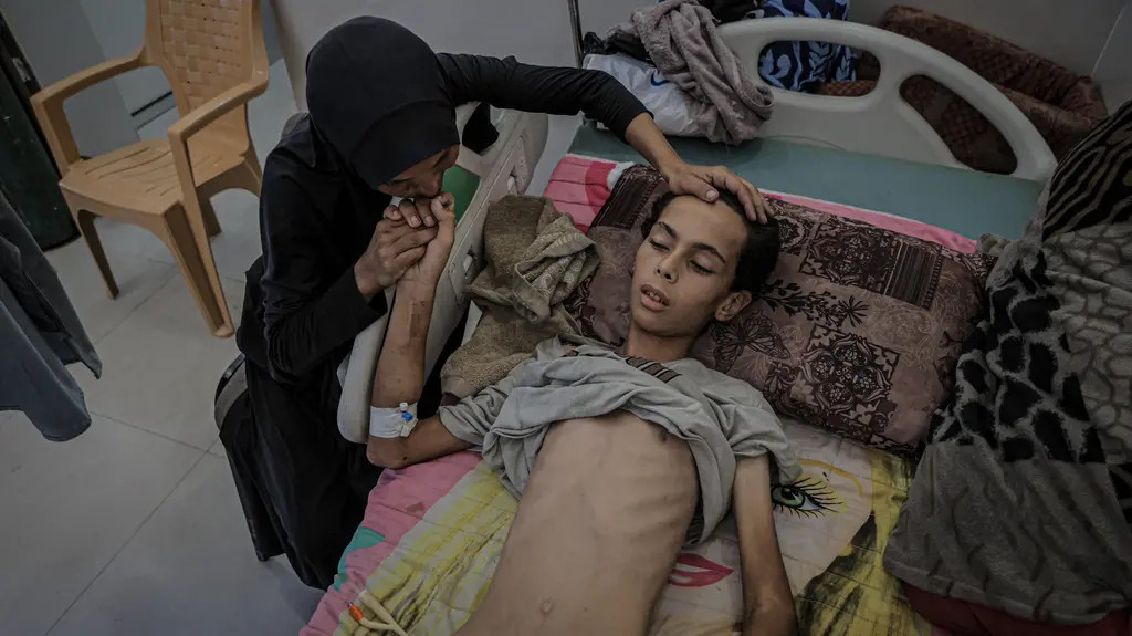 Teenager Artif Aíd abú Chátir se léčí v nemocnici al-Šífa kvůli podvýživě. Chlapec váží 25 kilogramů.